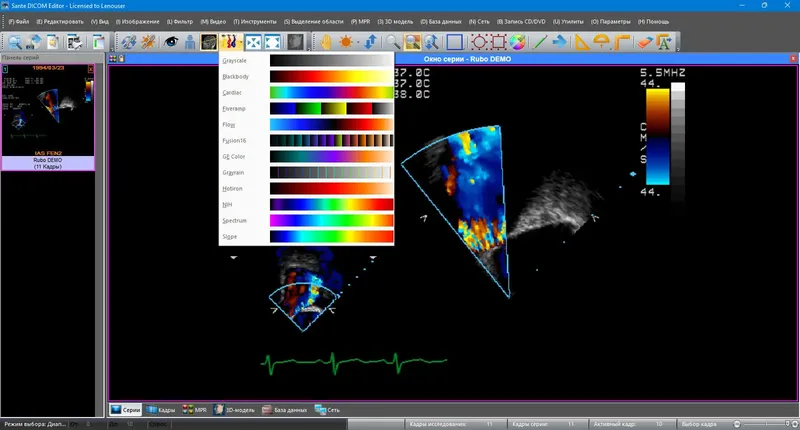 Инсталляция и активация