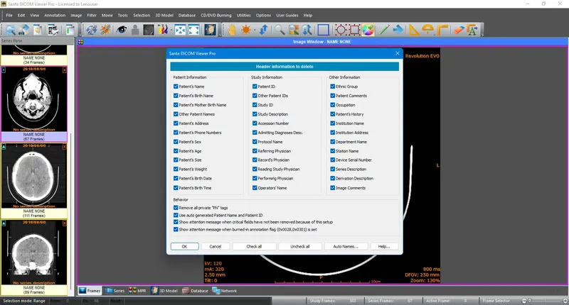 Инсталляция и активация
